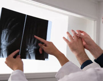 x-ray of damaged bones